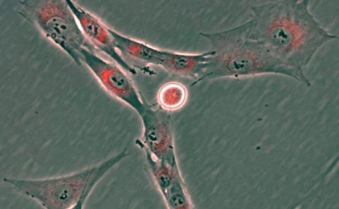 Skeletal stem cells